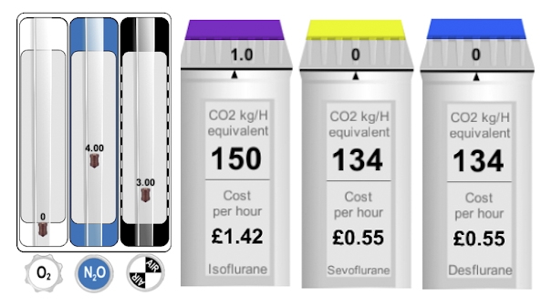 Anaesthetic Impact Calculator