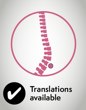 Epidural pain relief - translations available