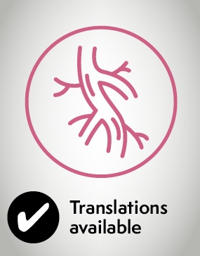Your anaesthetic for vascular surgery - translations available