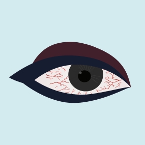 Injuries to the eye icon